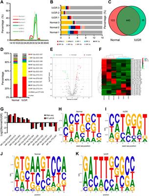 Identification of tRNA-derived small RNAs and their potential roles in porcine skeletal muscle with intrauterine growth restriction